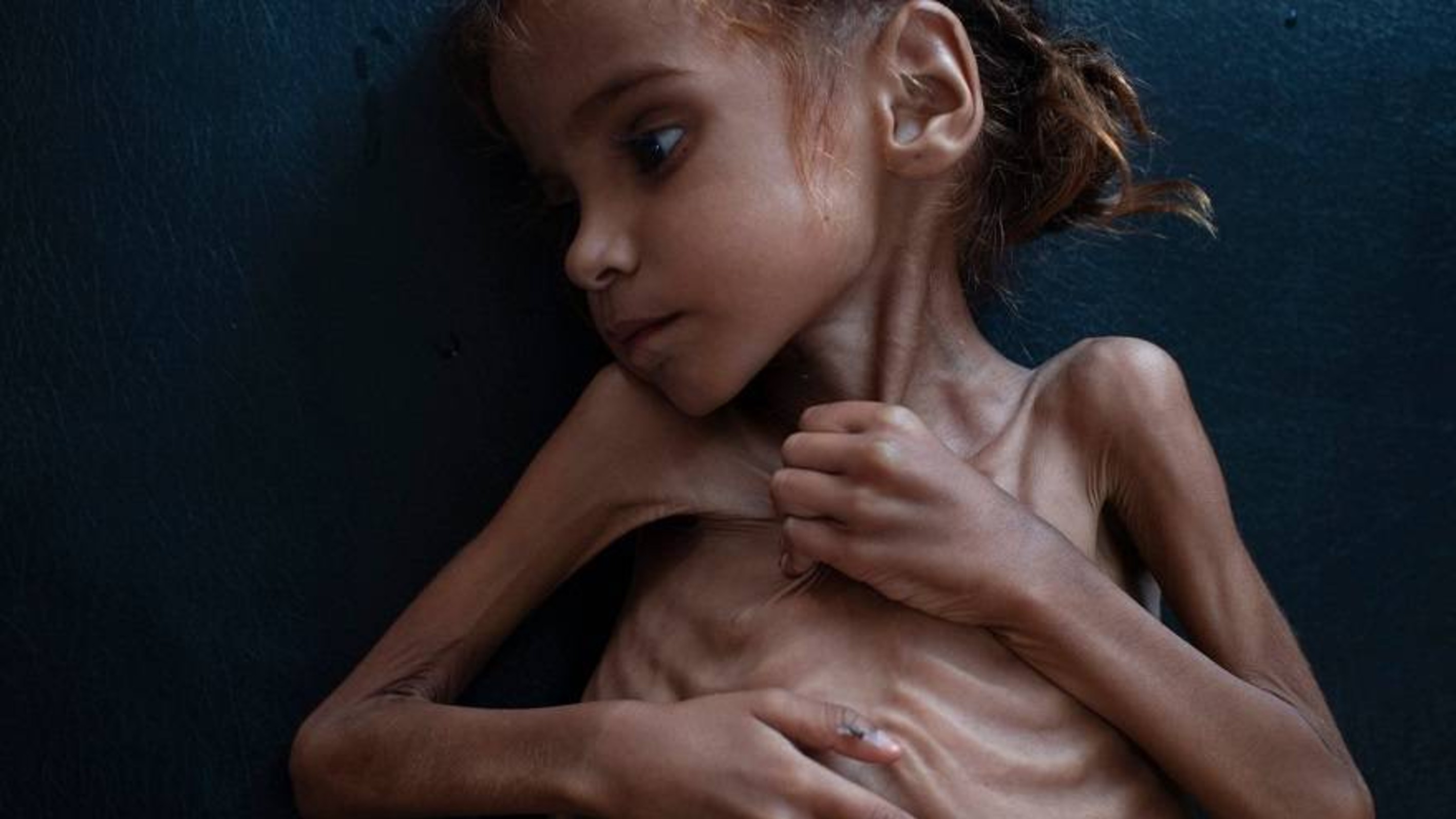 أمل...صورة تختزل الوضع الإنساني في اليمن
